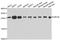 Ubiquitin Conjugating Enzyme E2 K antibody, MBS126112, MyBioSource, Western Blot image 