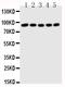 Signal Transducer And Activator Of Transcription 1 antibody, PA1508, Boster Biological Technology, Western Blot image 