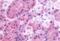 Gastrin Releasing Peptide Receptor antibody, NLS830, Novus Biologicals, Immunohistochemistry paraffin image 