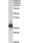 Glutathione S-transferase alpha-3 antibody, GTX49056, GeneTex, Western Blot image 