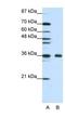 Fibrillarin antibody, NBP1-57272, Novus Biologicals, Western Blot image 