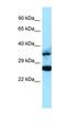 Ras Association Domain Family Member 2 antibody, orb331270, Biorbyt, Western Blot image 