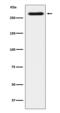 Sortilin Related Receptor 1 antibody, M01887-2, Boster Biological Technology, Western Blot image 