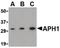 Aph-1 Homolog A, Gamma-Secretase Subunit antibody, PA5-20317, Invitrogen Antibodies, Western Blot image 