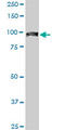 Autoantigen NOR-90 antibody, LS-B6167, Lifespan Biosciences, Western Blot image 