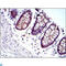 Junction Plakoglobin antibody, LS-C812522, Lifespan Biosciences, Immunofluorescence image 