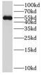 SRY-Box 10 antibody, FNab08120, FineTest, Western Blot image 