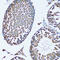 Farnesyl-Diphosphate Farnesyltransferase 1 antibody, STJ27985, St John