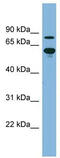 ATP Binding Cassette Subfamily F Member 2 antibody, TA332055, Origene, Western Blot image 