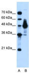 Alpha-enolase antibody, TA335867, Origene, Western Blot image 