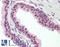 Zinc Finger Protein 451 antibody, LS-B9659, Lifespan Biosciences, Immunohistochemistry paraffin image 