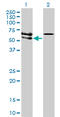 Activin A Receptor Like Type 1 antibody, LS-C196611, Lifespan Biosciences, Western Blot image 