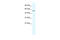 Zinc Finger Protein 286A antibody, 28-399, ProSci, Western Blot image 