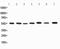 Potassium Voltage-Gated Channel Subfamily A Member 1 antibody, PA2296, Boster Biological Technology, Western Blot image 