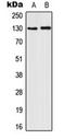 Colony Stimulating Factor 2 Receptor Beta Common Subunit antibody, orb216075, Biorbyt, Western Blot image 