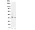 Cyclin D2 antibody, R30327, NSJ Bioreagents, Western Blot image 