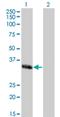 Mesenchyme Homeobox 1 antibody, H00004222-M03, Novus Biologicals, Western Blot image 