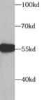 SUFU Negative Regulator Of Hedgehog Signaling antibody, FNab08373, FineTest, Western Blot image 