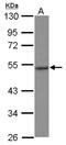 HSP13 antibody, NBP2-20509, Novus Biologicals, Western Blot image 