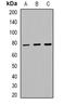 Forkhead Box O1 antibody, orb382453, Biorbyt, Western Blot image 