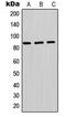 Phosphoinositide-3-Kinase Regulatory Subunit 2 antibody, LS-C352667, Lifespan Biosciences, Western Blot image 