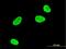 Serum/Glucocorticoid Regulated Kinase 1 antibody, H00006446-M04, Novus Biologicals, Immunocytochemistry image 