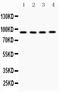Solute Carrier Family 6 Member 4 antibody, RP1068, Boster Biological Technology, Western Blot image 