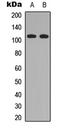 Ras Interacting Protein 1 antibody, LS-C354465, Lifespan Biosciences, Western Blot image 