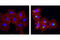 Transforming Growth Factor Beta Induced antibody, 5601T, Cell Signaling Technology, Immunocytochemistry image 