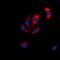 Mitogen-Activated Protein Kinase Kinase 6 antibody, abx133637, Abbexa, Western Blot image 