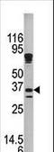 Kallikrein Related Peptidase 9 antibody, LS-C100102, Lifespan Biosciences, Western Blot image 