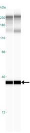 Olfactomedin 4 antibody, NBP2-24535, Novus Biologicals, Western Blot image 