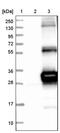 HscB Mitochondrial Iron-Sulfur Cluster Cochaperone antibody, PA5-53802, Invitrogen Antibodies, Western Blot image 