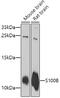 S100 Calcium Binding Protein B antibody, GTX57757, GeneTex, Western Blot image 