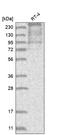 Transforming Acidic Coiled-Coil Containing Protein 2 antibody, HPA031021, Atlas Antibodies, Western Blot image 