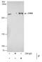 Chromodomain Helicase DNA Binding Protein 4 antibody, PA5-27472, Invitrogen Antibodies, Immunoprecipitation image 