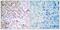 RB Transcriptional Corepressor 1 antibody, PA5-38146, Invitrogen Antibodies, Immunohistochemistry paraffin image 