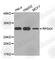 40S ribosomal protein S4, X isoform antibody, A4092, ABclonal Technology, Western Blot image 