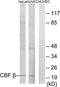 Core-Binding Factor Subunit Beta antibody, TA313562, Origene, Western Blot image 