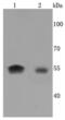 Cytochrome P450 Family 19 Subfamily A Member 1 antibody, NBP2-67166, Novus Biologicals, Western Blot image 