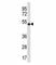 Apolipoprotein B MRNA Editing Enzyme Catalytic Subunit 3G antibody, F40028-0.4ML, NSJ Bioreagents, Western Blot image 