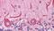 B Cell Receptor Associated Protein 31 antibody, PA5-18029, Invitrogen Antibodies, Immunohistochemistry paraffin image 