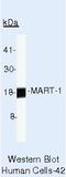 Melan-A antibody, MA5-15237, Invitrogen Antibodies, Western Blot image 