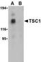TSC Complex Subunit 1 antibody, NBP1-76618, Novus Biologicals, Western Blot image 