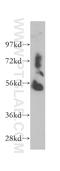 Tryptophanyl TRNA Synthetase 2, Mitochondrial antibody, 13944-1-AP, Proteintech Group, Western Blot image 