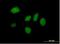 Death Inducer-Obliterator 1 antibody, H00011083-B01P, Novus Biologicals, Immunofluorescence image 