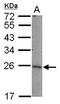 Protein lin-7 homolog B antibody, PA5-31018, Invitrogen Antibodies, Western Blot image 
