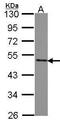 Splicing Factor 3b Subunit 4 antibody, GTX106389, GeneTex, Western Blot image 