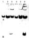 Collagen Type V Alpha 1 Chain antibody, NBP1-05118, Novus Biologicals, Western Blot image 