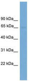 Interleukin 1 Receptor Like 2 antibody, TA339385, Origene, Western Blot image 
